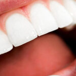 Dowiedz się jak uzyskać piękny uśmiech i poprawić stan zębów